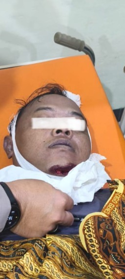 Warga Sumberagung Meninggal Tragis Usai Diduga Terpeleset di Area Kesenian Tiban