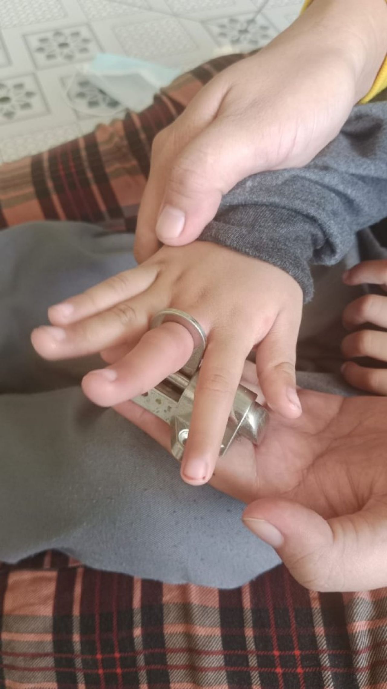 Jari Jovino yang masuk ke lubang kunci jendela sebelum di evakuasi tim Damkar. (Ist)