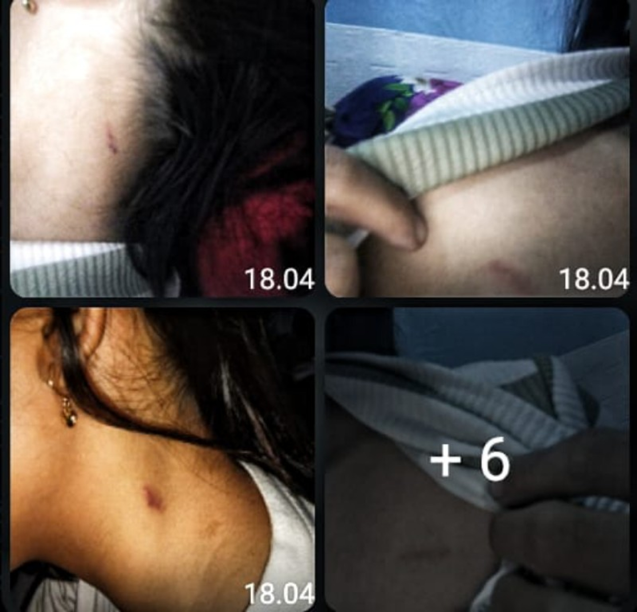 foto -foto korban yang diduga jadi pelecehan seksual. (ist)